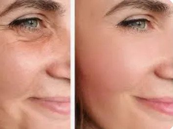 Facelift Surgery in Mumbai By Dr. Hemang Sanghvi – Face Lift Specialist
