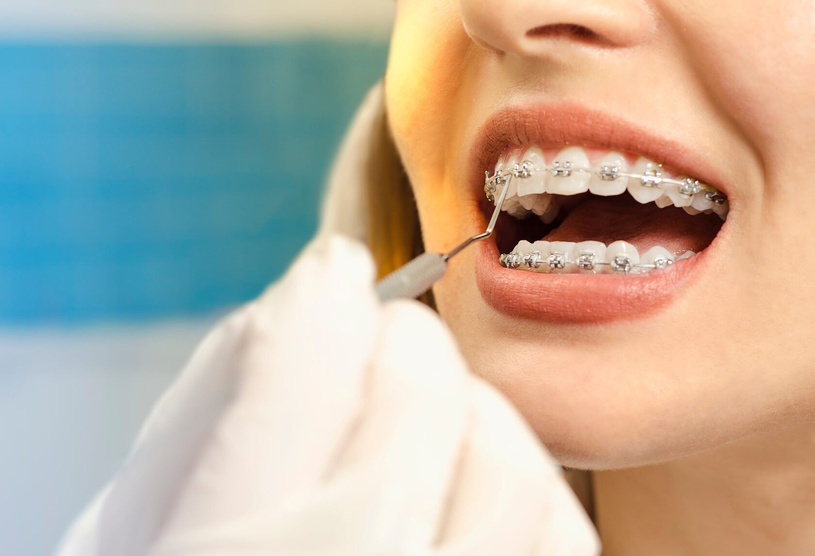 Best Orthodontist in Thane | Agrawal Dental Clinic