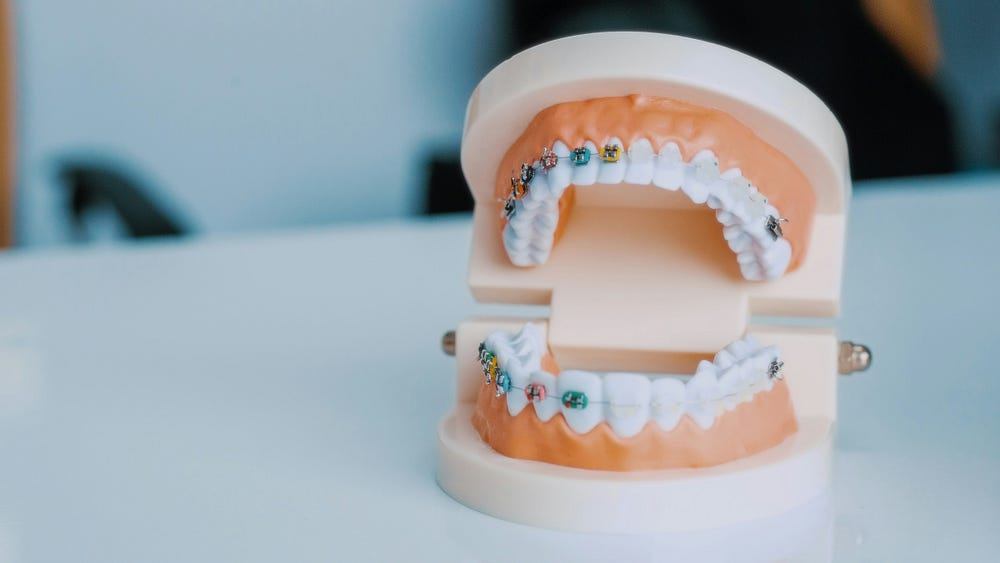 Clear Aligners For Gap Teeth Correction In Tamil Nadu